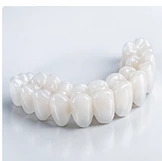Arcada de dientes provisionales blancos con apariencia natural